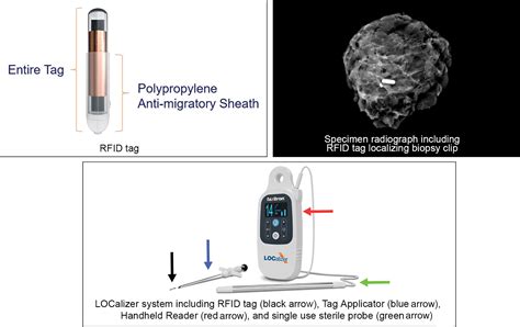 rfid tag production process|rfid tagging in breast surgery.